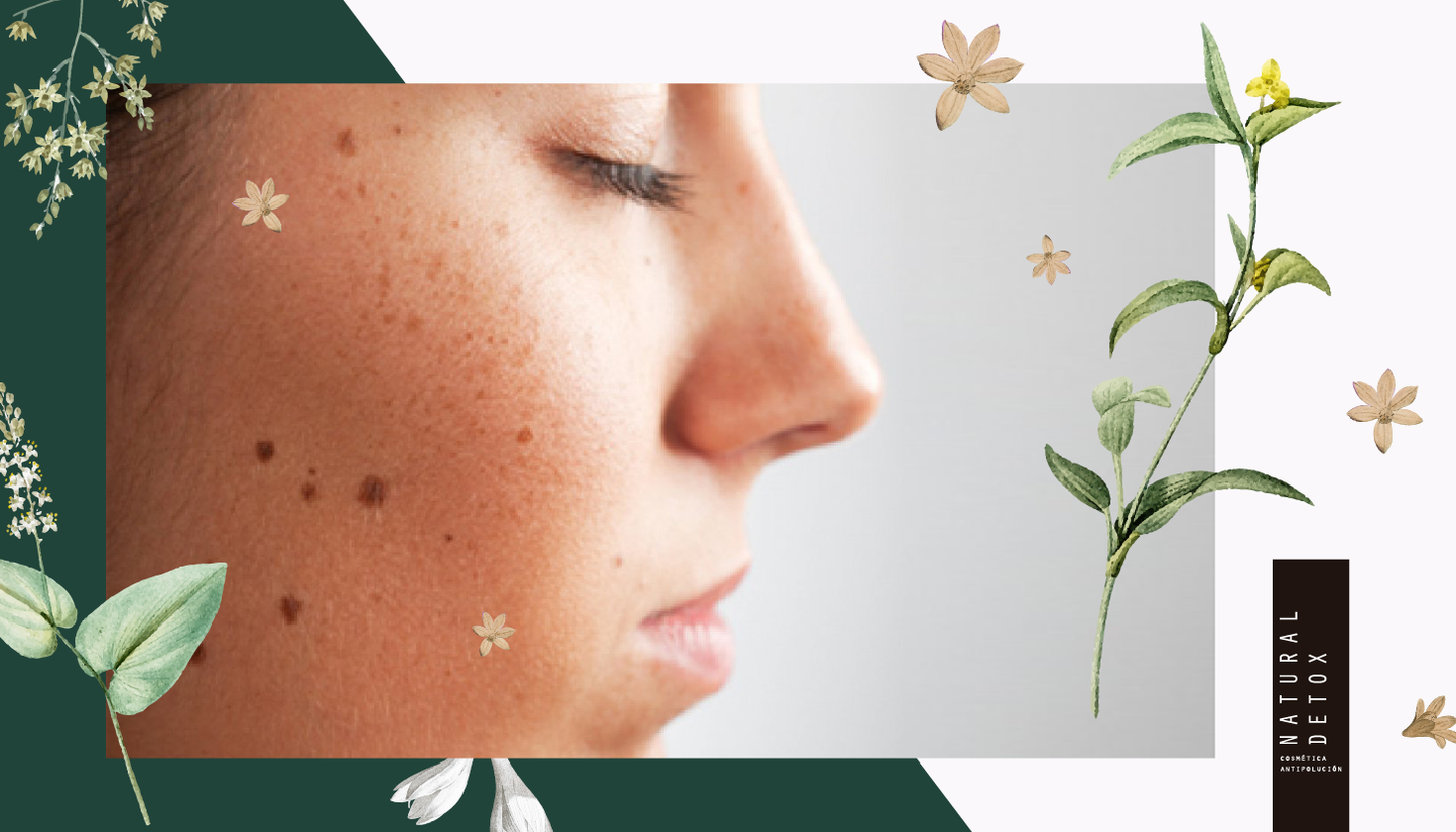 ¿Tienes manchas? ¡Tu piel necesita nuestro aceite de Rosa Mosqueta!