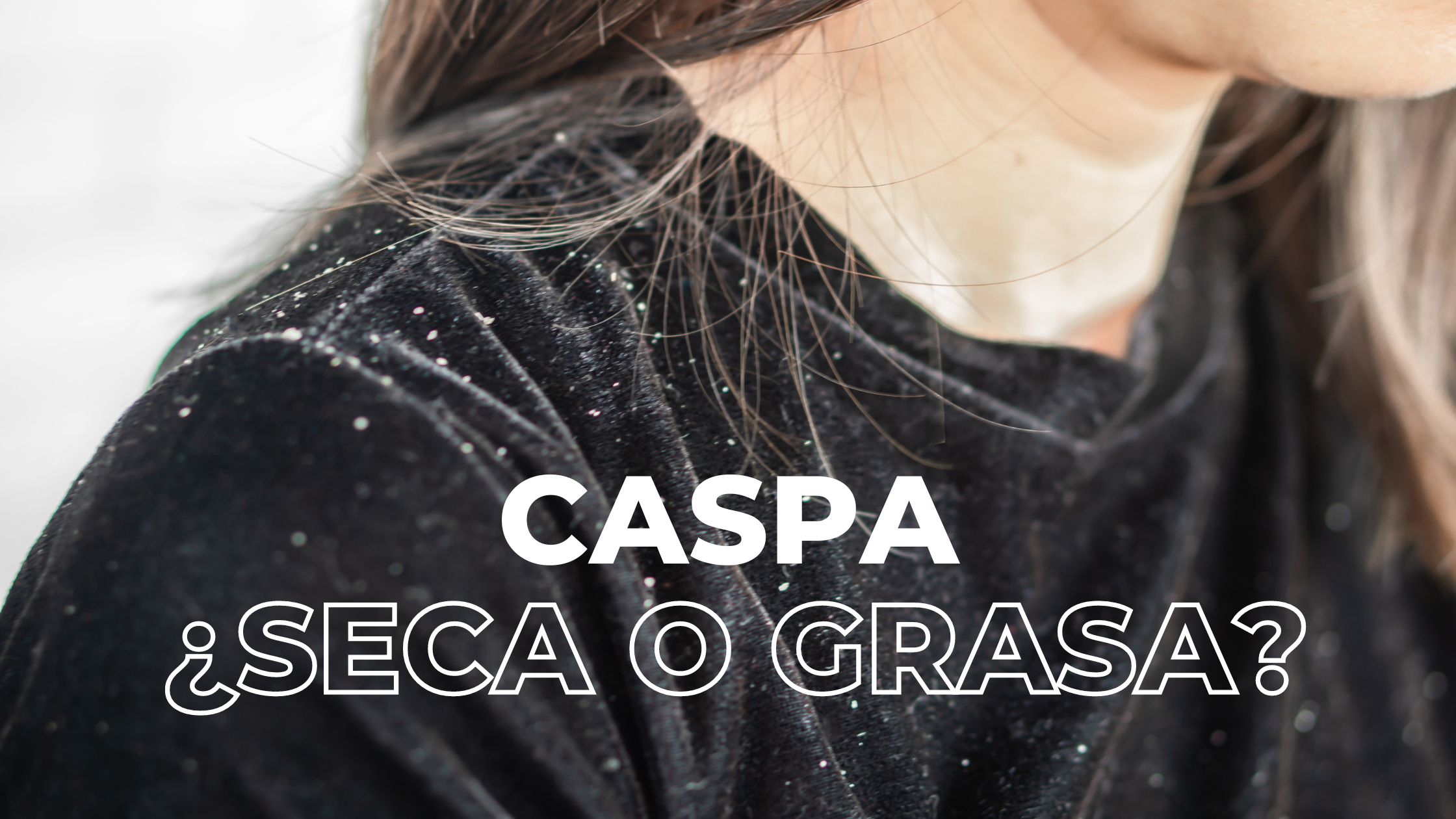 ¿Caspa seca o caspa grasa ?